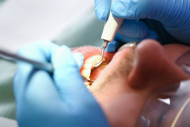Best After-Hours Dental Trauma Care in North Kensington, MD